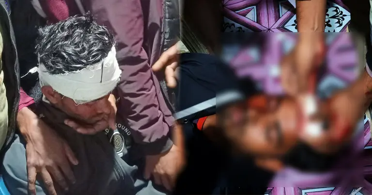 হামলায় আহতদের চিকিৎসা চলছে